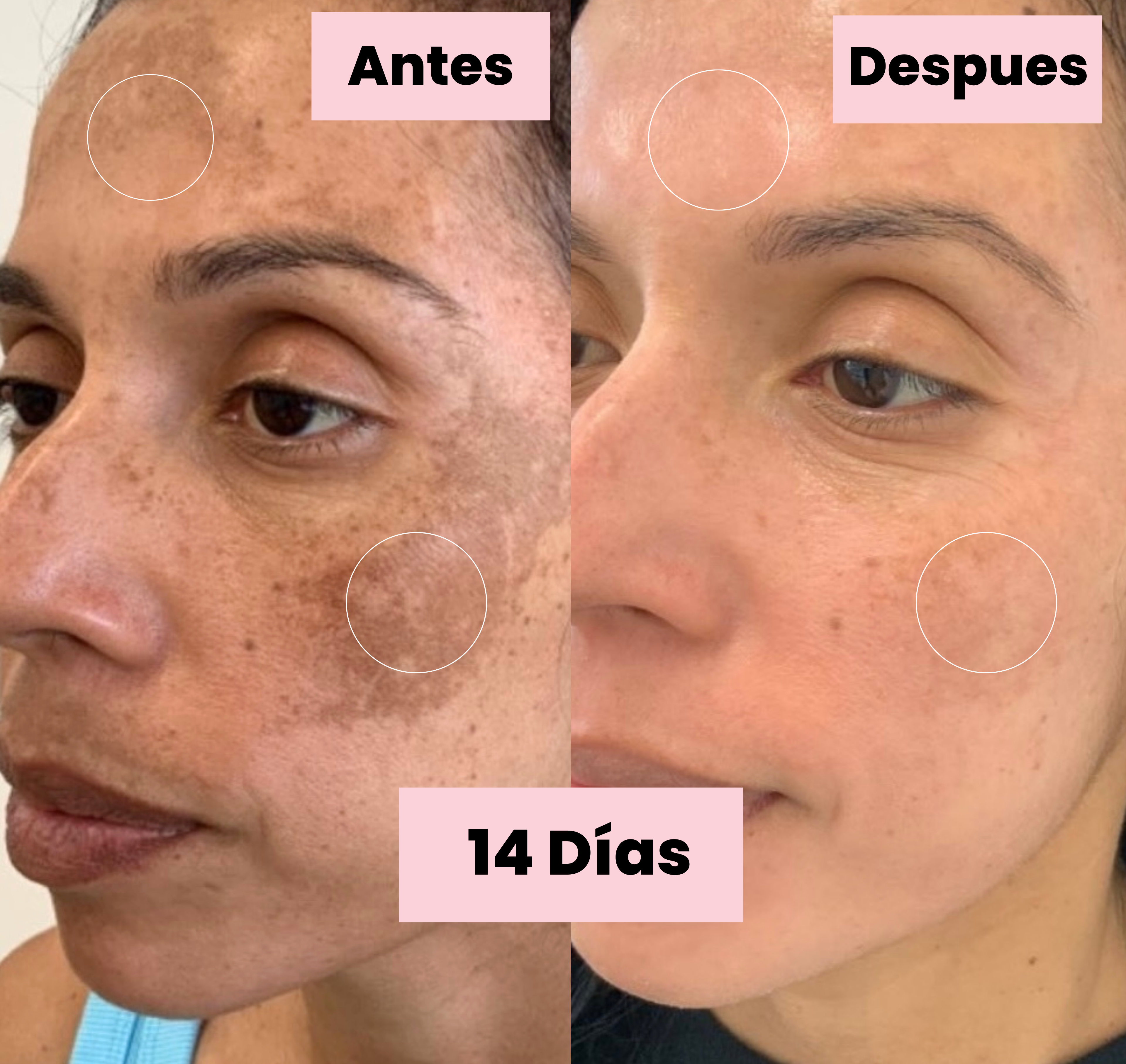Tónico Despigmentante LB